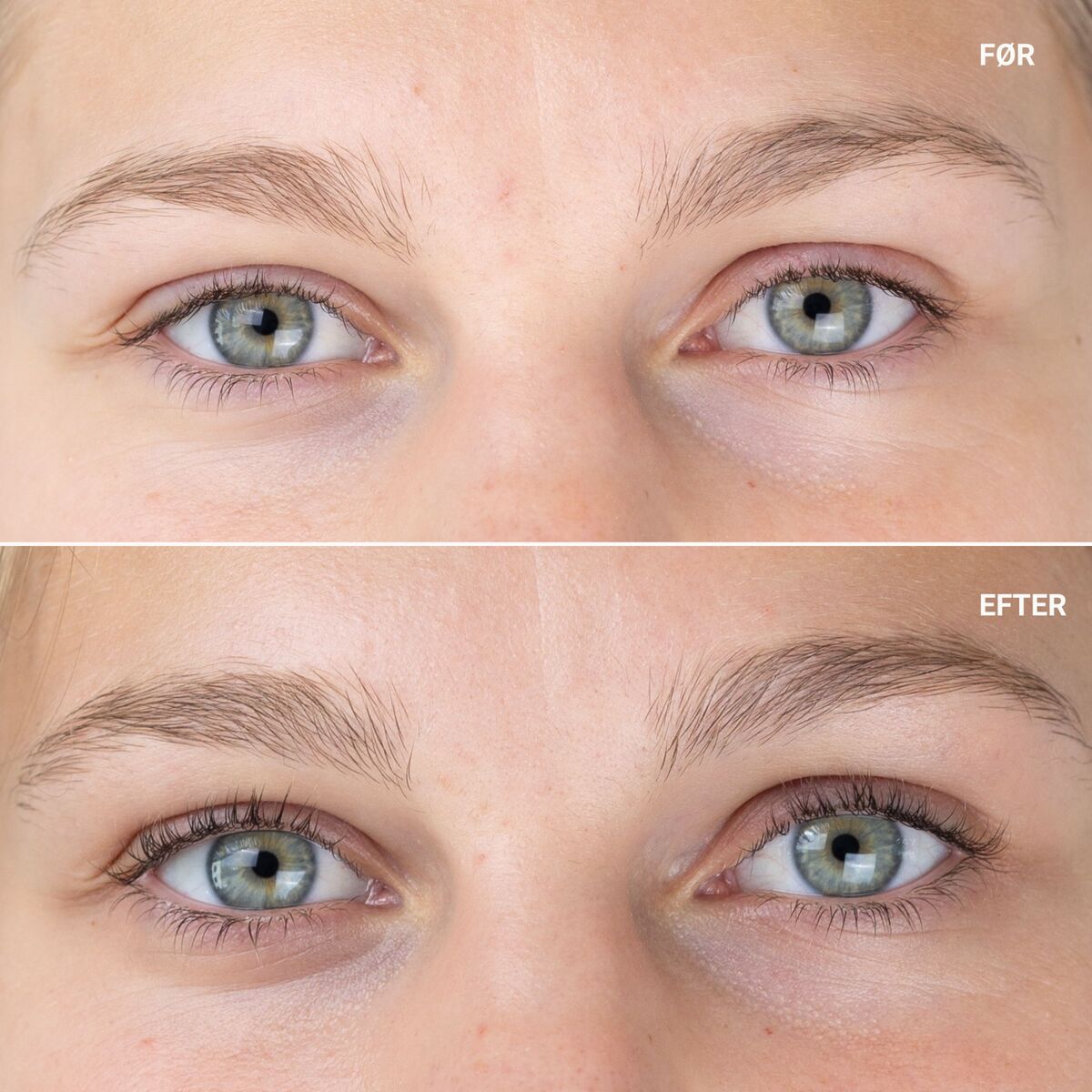 Eyelash Growth Serum With Sanzi Growth Complex 5 ml