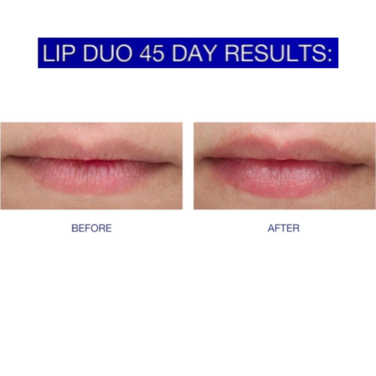 Lip Duo Set