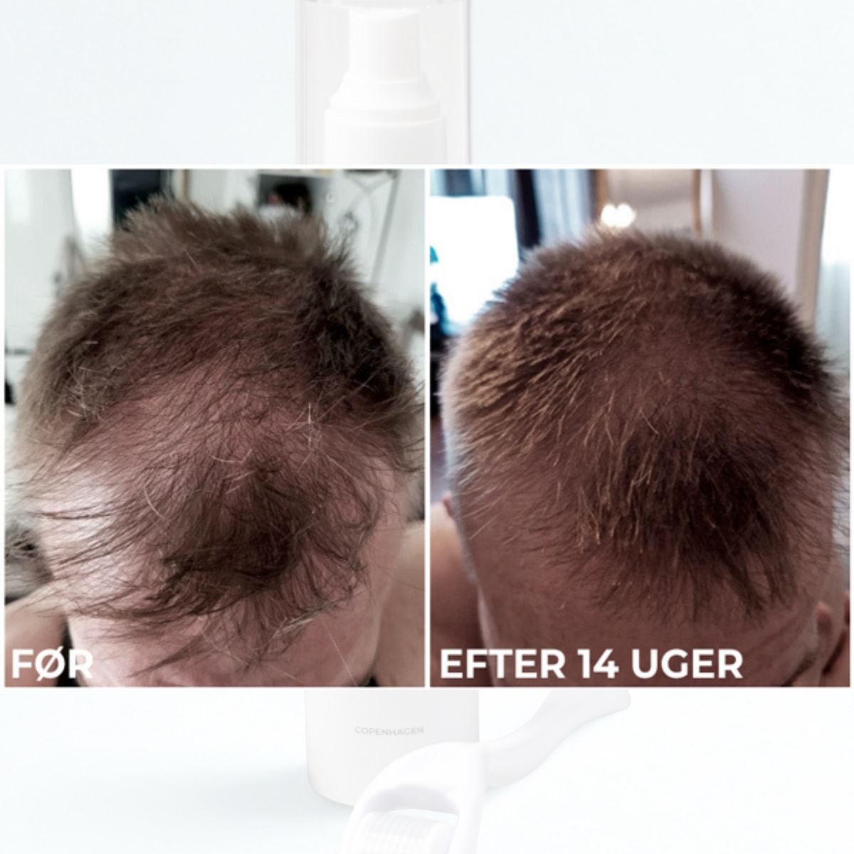 Hair Growth Serum With Sanzi Growth Complex™