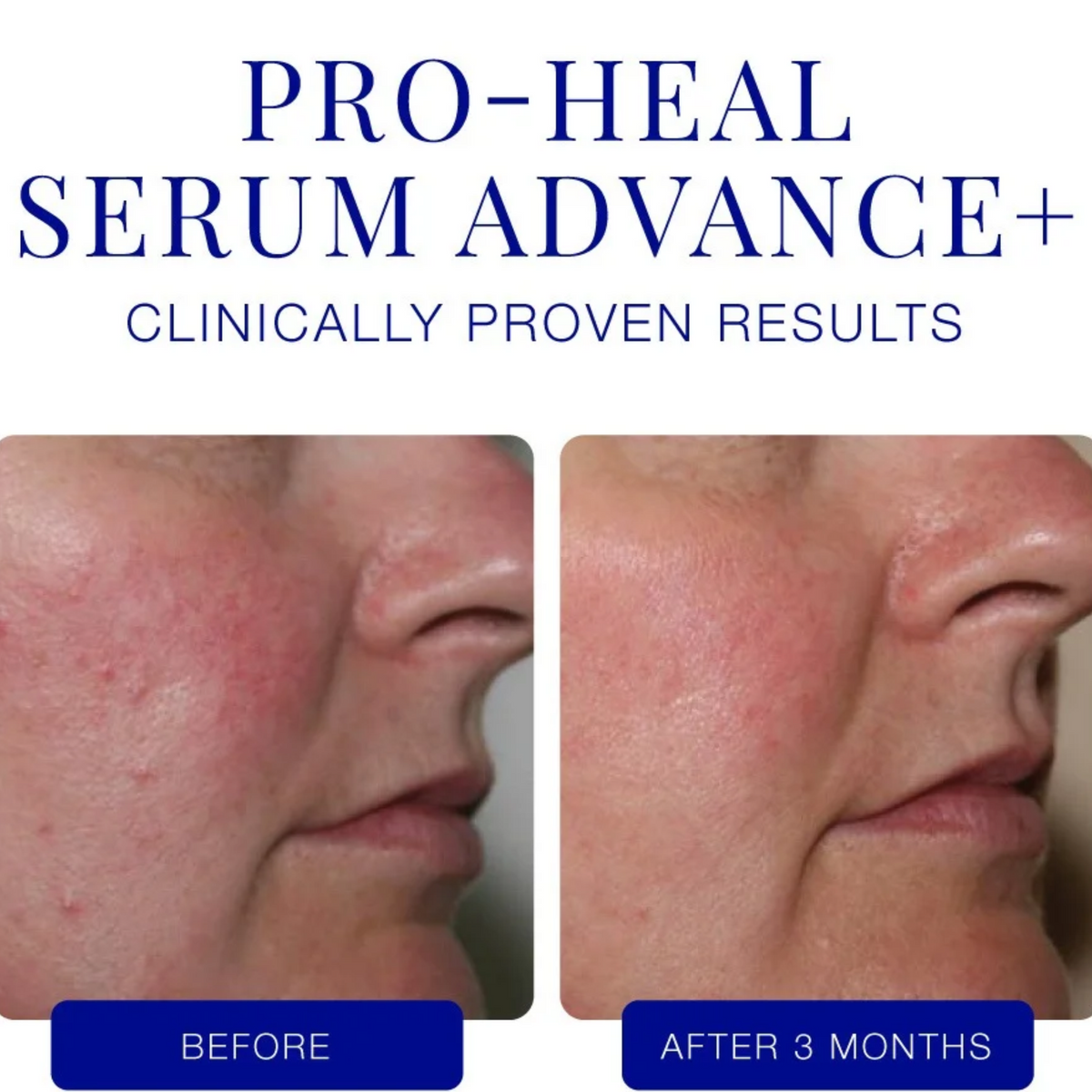 Pro-Heal Serum Advance+